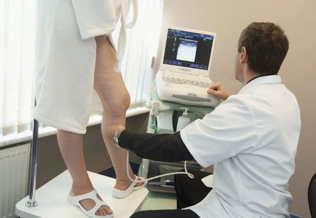 Diagnostic des varices