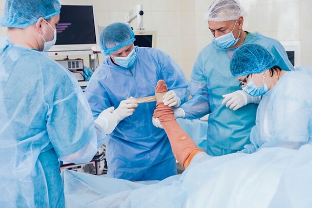 Chirurgie de varicose